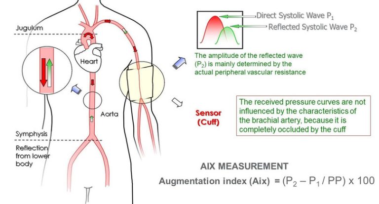 Augmentation Index | Arteriograph Company