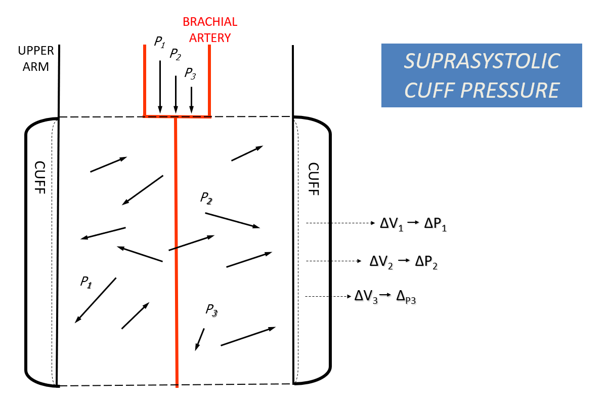 Arteriograph Algorithm